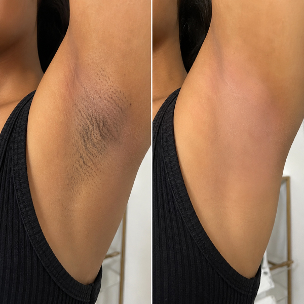 Before-and-after-underarm-waxing-service-at-avissa-salon-in-ann-arbor-michigan
