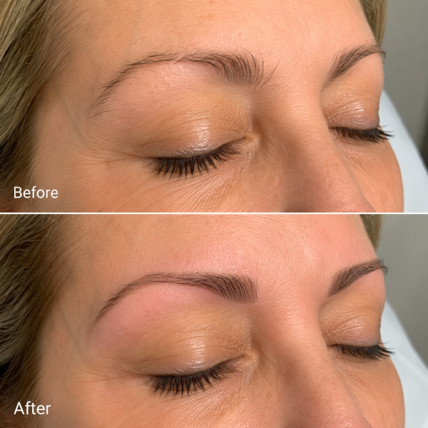 Brow-Waxing-before-and-after-at-Avissa-Salon-in-Ann-Arbor-Michigan.-House-of-expert-Waxist-in-Ann-Arbor-
