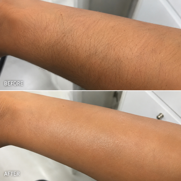 Full-Arms-waxing-at-Avissa-Salon-in-Ann-Arbor-Michigan