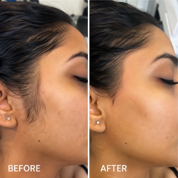 Professional-Facial-waxing-at-Avissa-Salon-in-Ann-Arbor-Michian.-Book-a-waxing-appointment-today.-